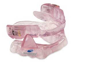 睡眠時無呼吸症候群用のオーラルアプライアンス（口腔内装置）
