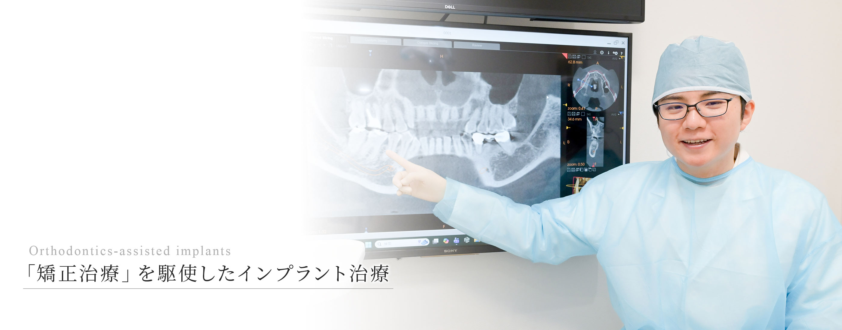 「矯正治療」を駆使したインプラント治療