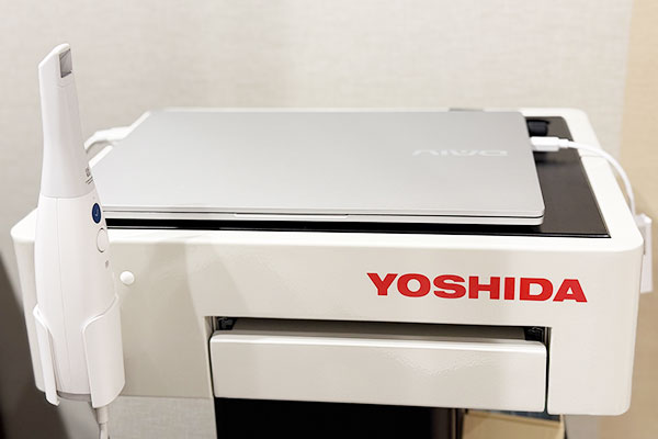 口腔内スキャナー