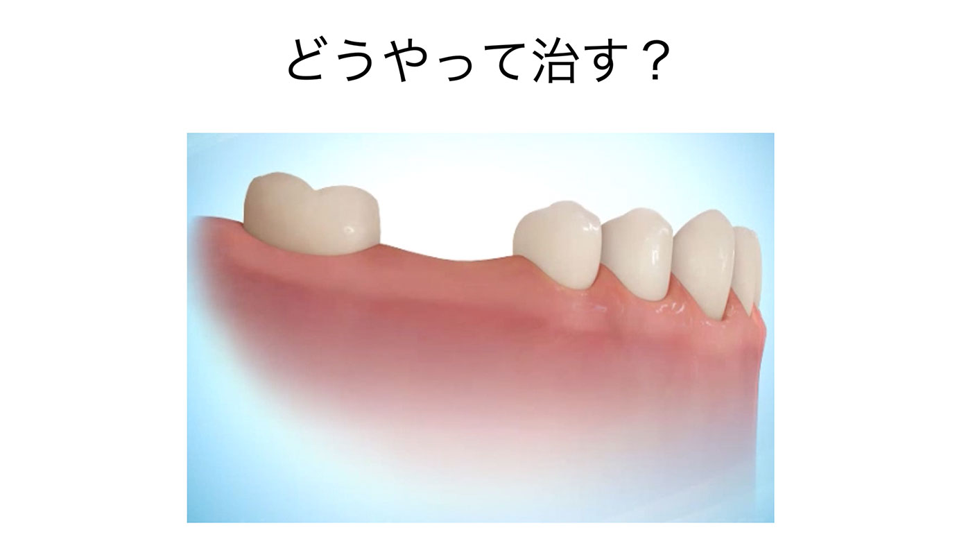 どうやって治す？