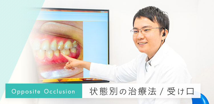 臨床医のための床矯正・矯正治療 反対咬合篇 シエン社 | 臨床医のため