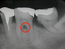 ルートセパレーション